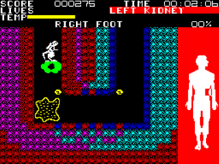 Fantastic Voyage screenshot 3 for ZX Spectrum